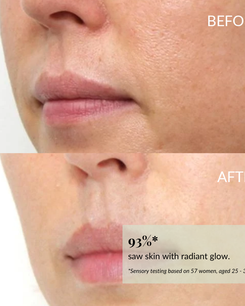 Close-up of the lower face shows smoother, more radiant skin after using IREN Shizen BLOOM OF YOUTH Restoring Facial Oil with prebiotics & postbiotics; text box highlights a 93% improvement compared to before. #show-lang-en