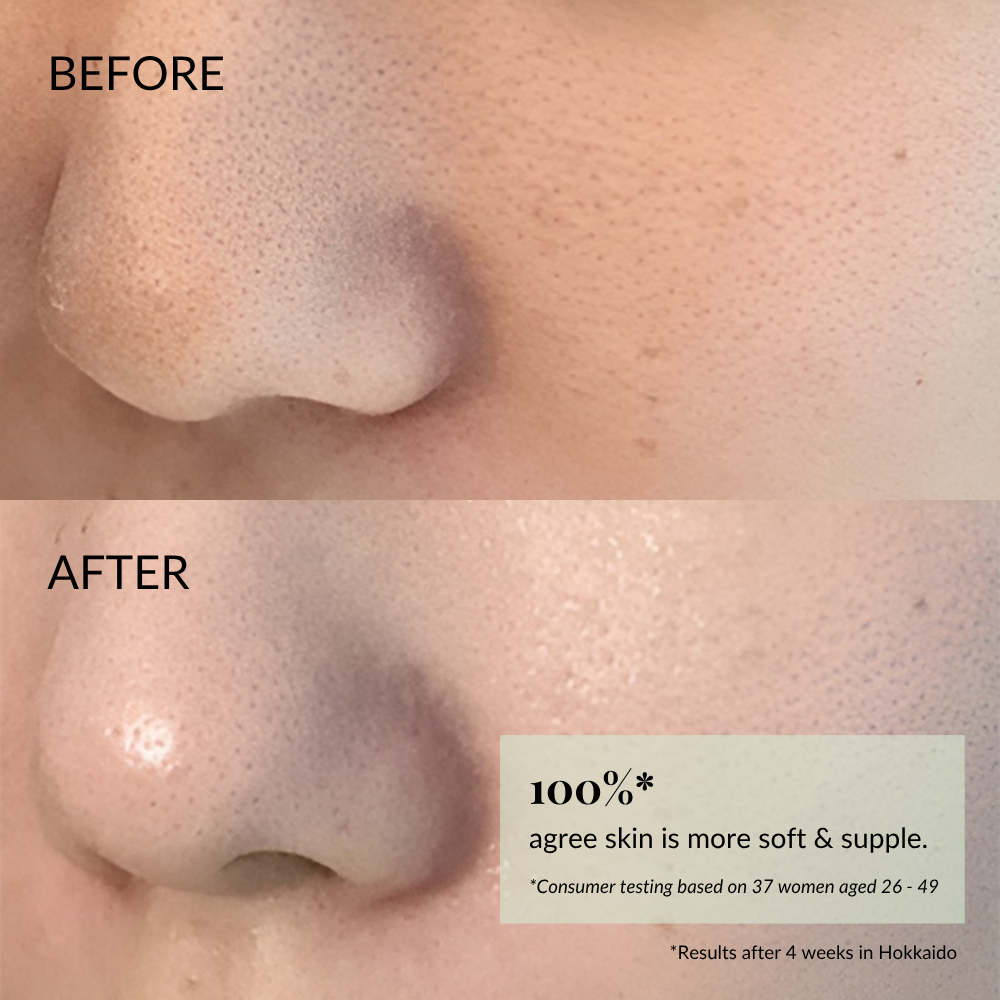Close-up of a nose and cheek before and after using IREN Shizen FLOWERS IN BLOOM Antioxidant Water Cream; "after" image shows visibly smoother, softer skin with a 100% improvement claim in the corner. #show-lang-en