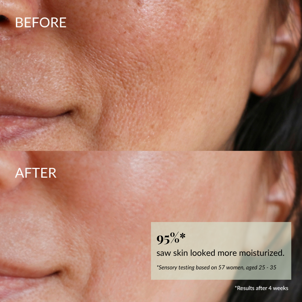 Close-up of a woman's cheek and mouth area shows plumper, less dry skin in the "after" image, demonstrating the moisturizing results of IREN Shizen QUENCH-UP Hydrating Serum.
#show-lang-en