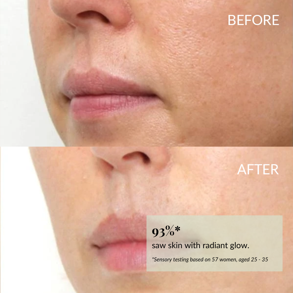 Close-up of the lower face shows smoother, more radiant skin after using IREN Shizen BLOOM OF YOUTH Restoring Facial Oil with prebiotics & postbiotics; text box highlights a 93% improvement compared to before.