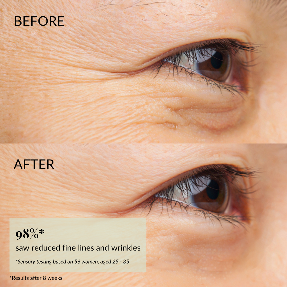 Close-up of eye area shows visible fine lines "before" and smoother, youthful skin "after"; text highlights reduced wrinkles with IREN Shizen FOREVER YOUNG Anti-Aging Serum infused with anti-aging peptides. #show-lang-en